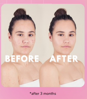 Blemish Repair (Spot Treatment)