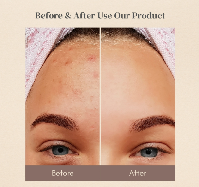 Blemish Repair (Spot Treatment)