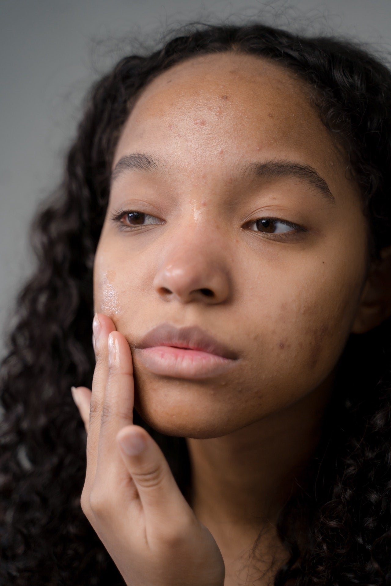 Skin Condicion SKIN CONDITIONS 101: HOW TO NOURISH THE SKIN – Lunah Life